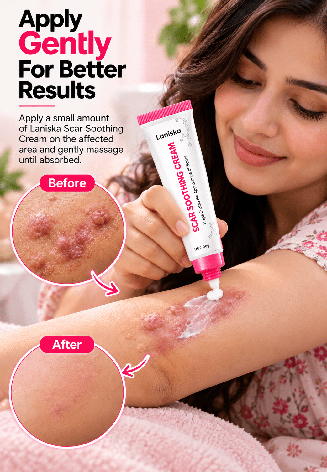 Scar Soothing Cream For Skin Tags & Surgical Scars