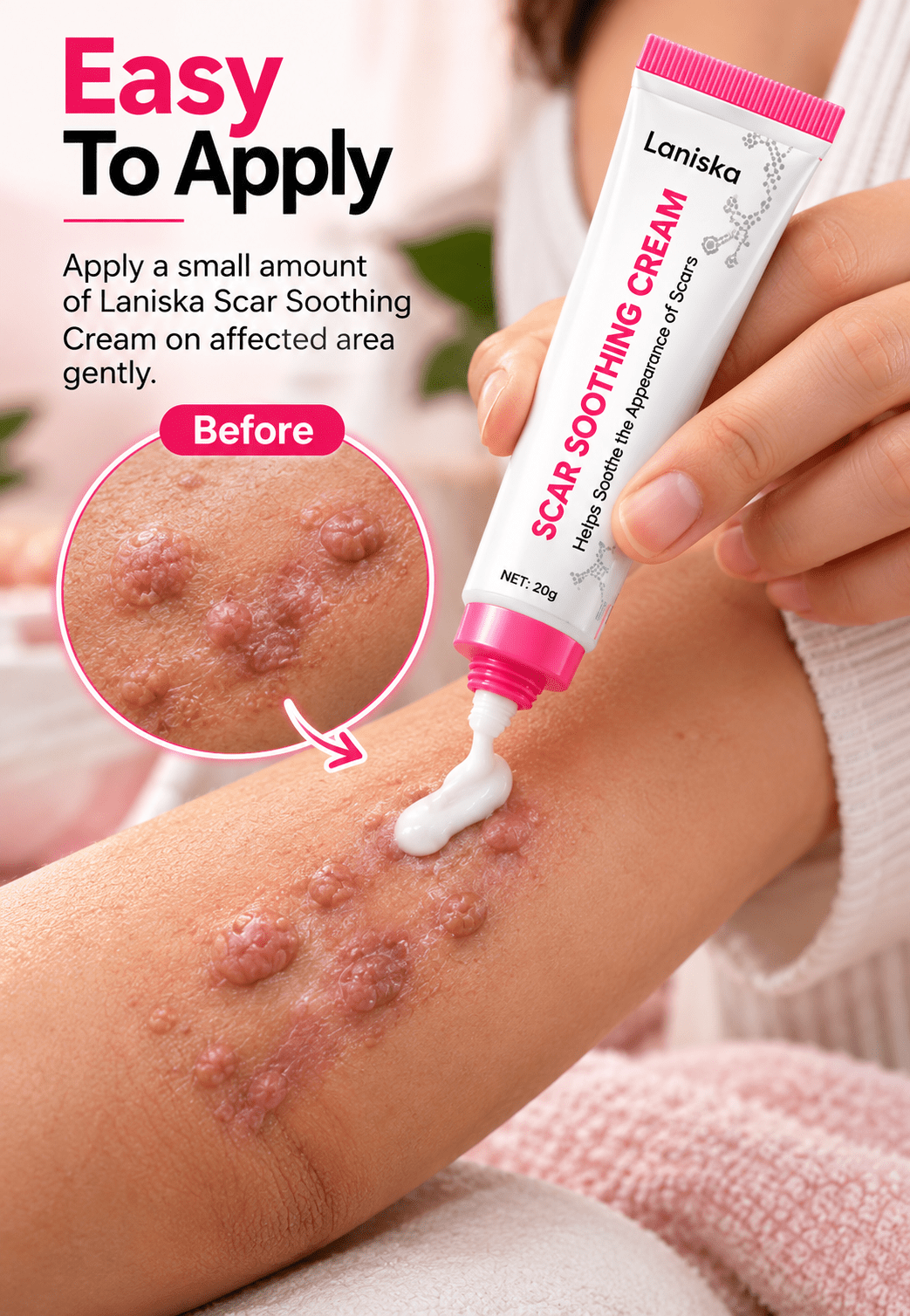 Scar Soothing Cream For Skin Tags & Surgical Scars