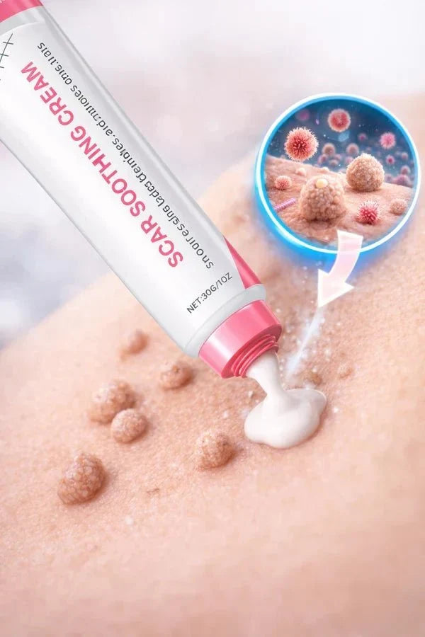 Scar Soothing Cream For Skin Tags & Surgical Scars
