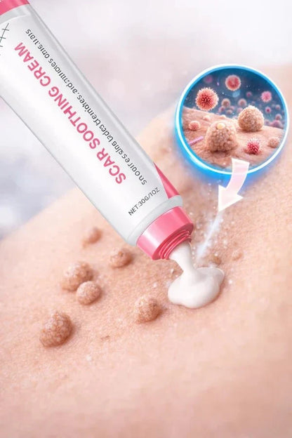 Scar Soothing Cream For Skin Tags & Surgical Scars